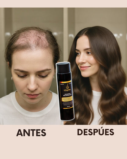 SHAMPOO RECUPERADOR + ENVIO GRATIS